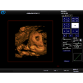 l&#39;hôpital a utilisé le scanner d&#39;ultrason de 3D 4D et le prix de doppler de couleur